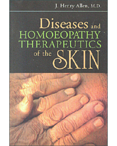 Diseases and Homoeopathy Therapeutics of the Skin